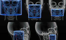 Fotografia w laryngologii